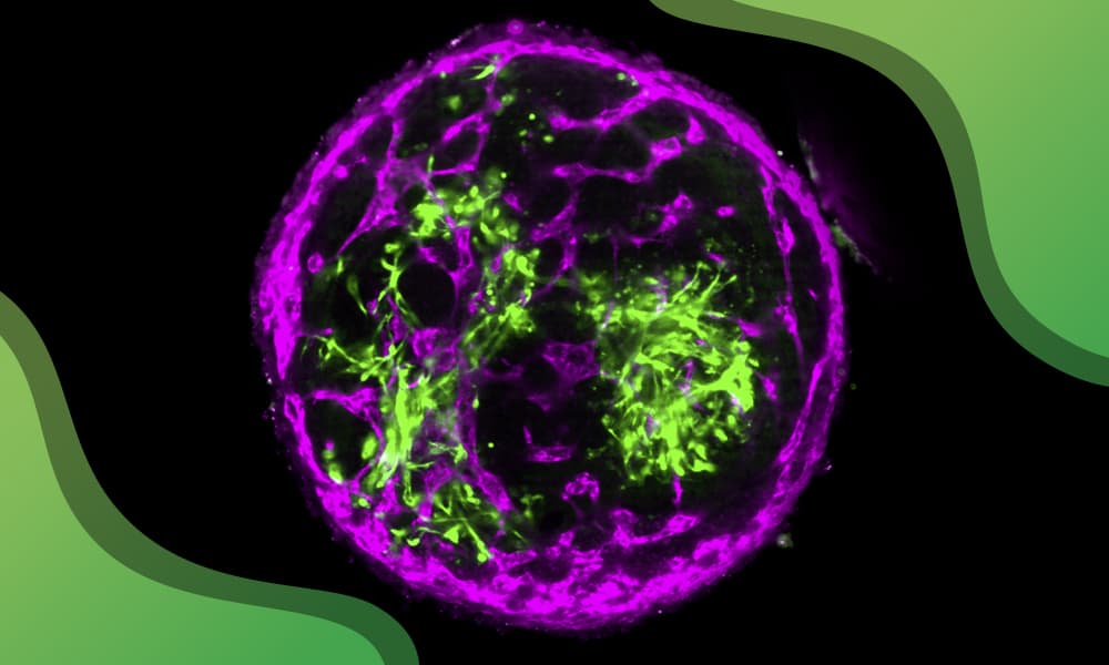 3D bovine tissue containing muscle fibres and blood vessel-like networks.